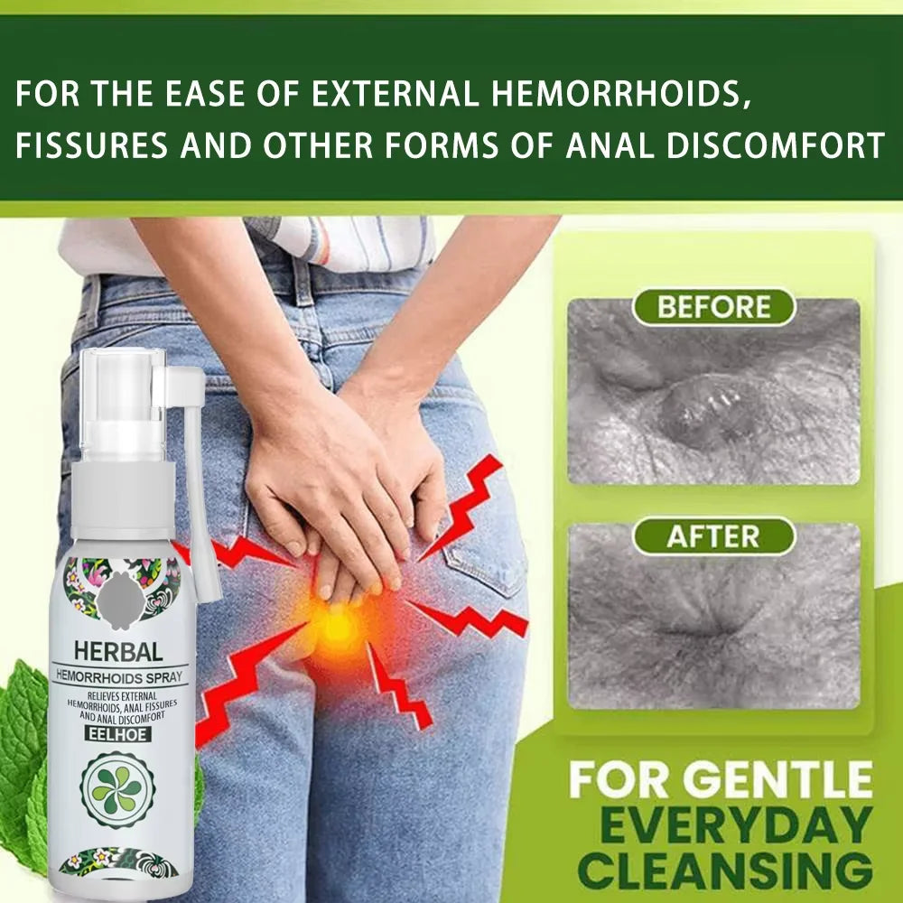 Herbal Hemorrhoids Spray, 2 Flaschen Körperpflegespray, Natürliche