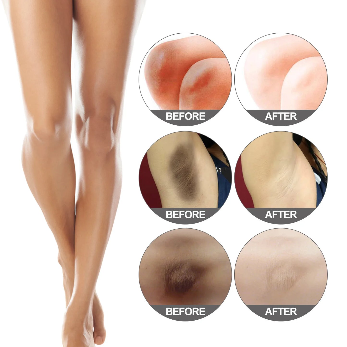 Private part Whitening Snow Bleach Cream
