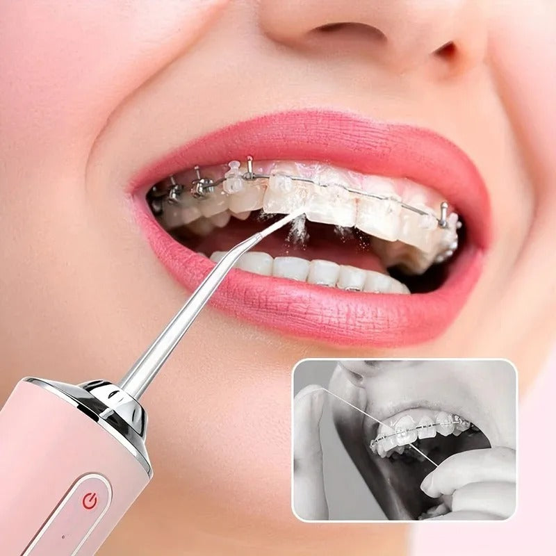 Water Flosser The luxury of cleaning with water