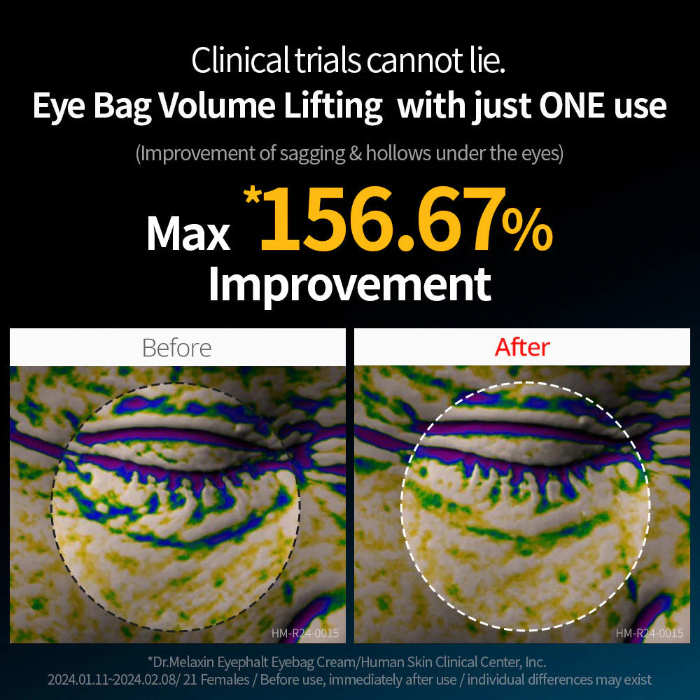 كريم دكتور ميلاكسين للعين لعلاج الهالات السوداء - 10 مل