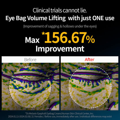 كريم دكتور ميلاكسين للعين لعلاج الهالات السوداء - 10 مل