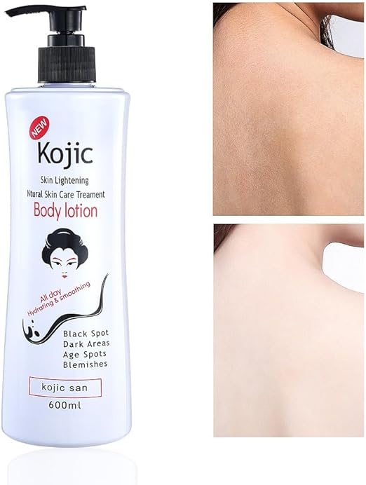 Kojic Acid Skin Lightening Body Lotion