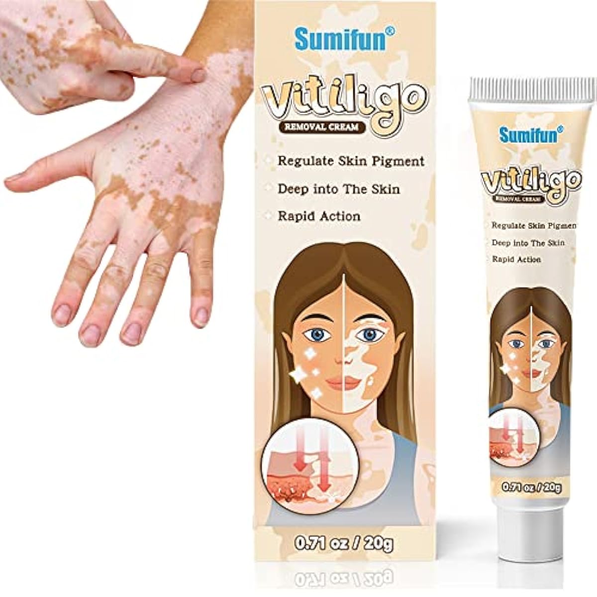 Sumifun Vitiligo Treatment Cream