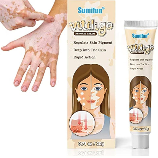 Sumifun Vitiligo Treatment Cream