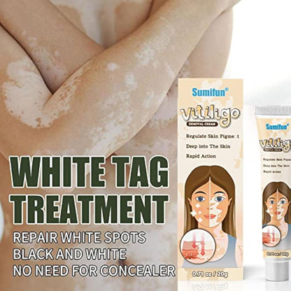Sumifun Vitiligo Treatment Cream