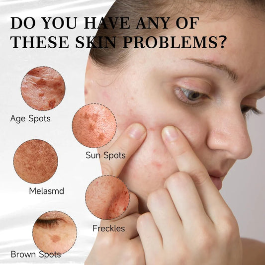 Aobenz Dark Spot Serum Remover