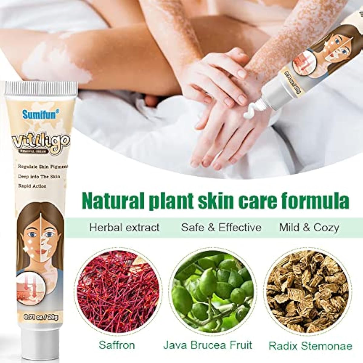 Sumifun Vitiligo Treatment Cream