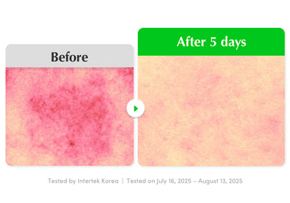 إيكوالبيري - سيروم مهدئ بخلاصة الصبار (30 مل)