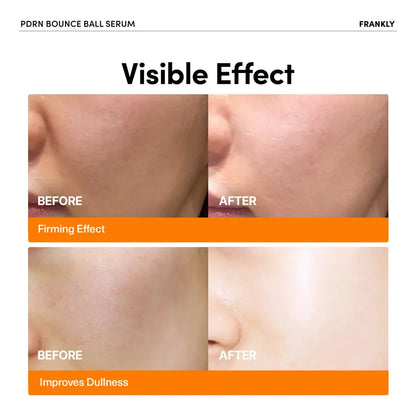 Frankly - PDRN Bounce Ball Serum [30ml]