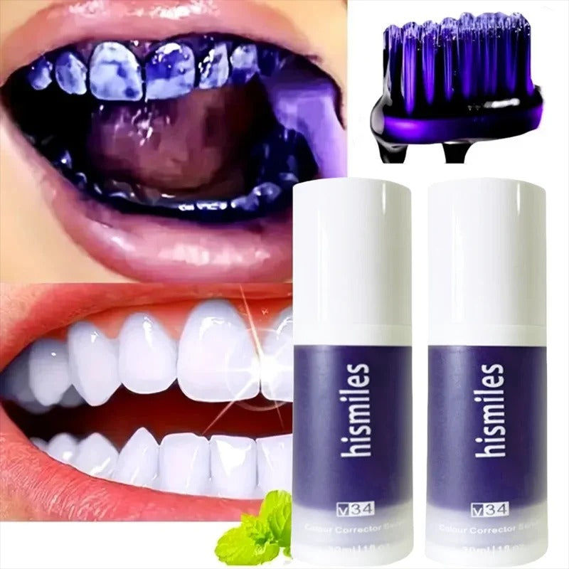 HiSmiles V34™ – No More Yellow Stains, Just Bright Smiles