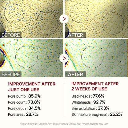 Dr.Melaxin Peel Shot Exfoliating White Rice Ampoule - 80ml