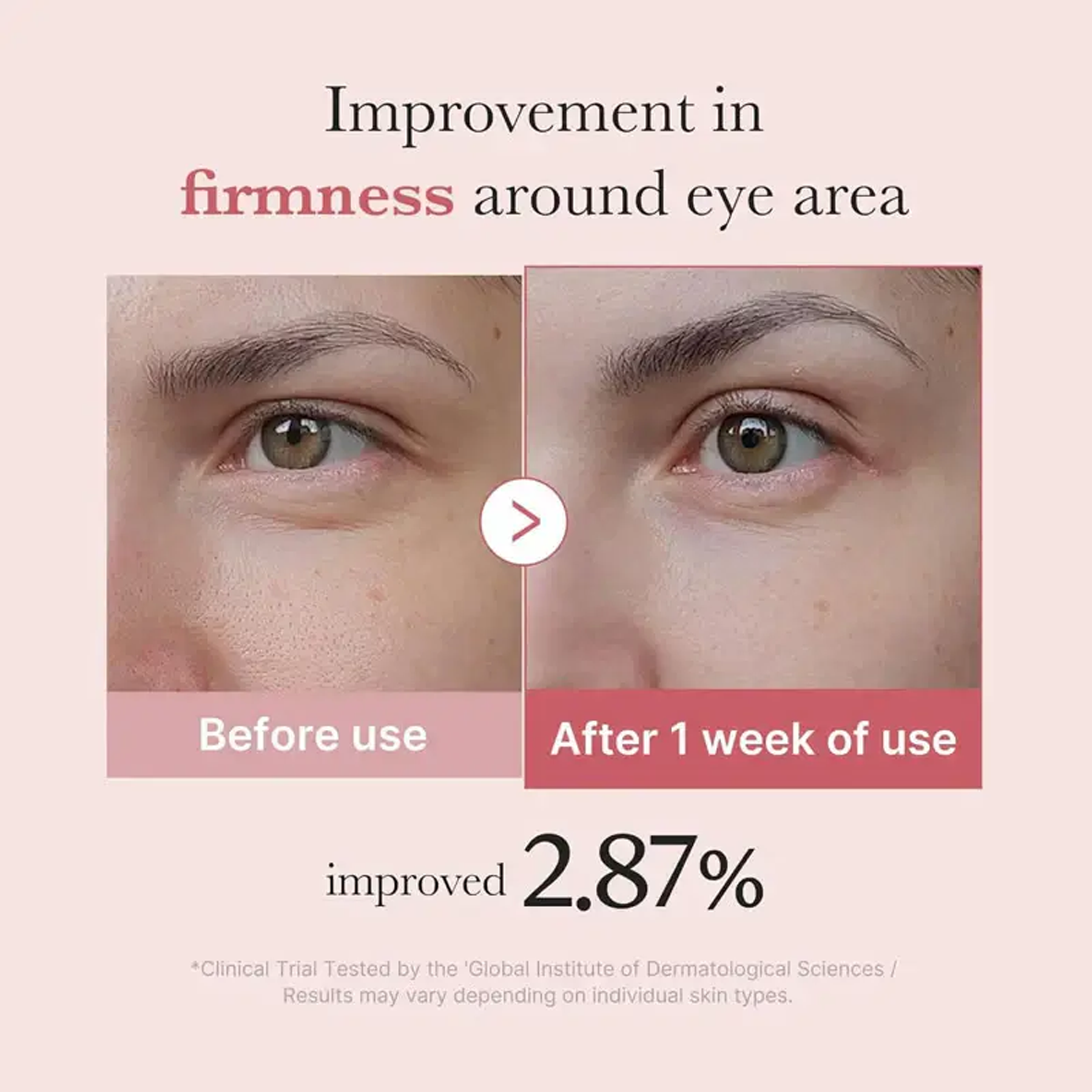 Key benefits of Medicube PDRN Pink Peptide Eye Cream: firmer under-eyes, softened fine lines and hydration