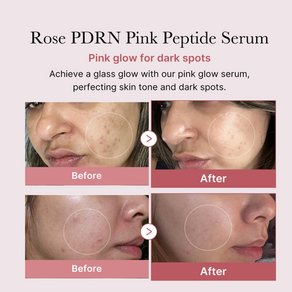 Before and after using Medicube PDRN Pink Peptide Serum for two weeks