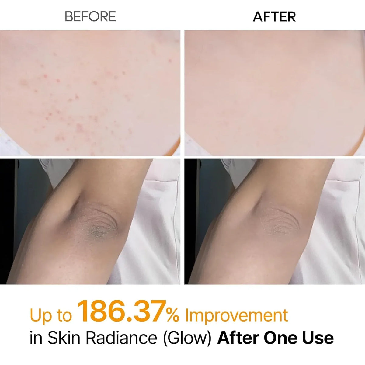 Dr.Melaxin Peel Shot Kojic Acid Spray ingredients — EmartGCC Kuwait