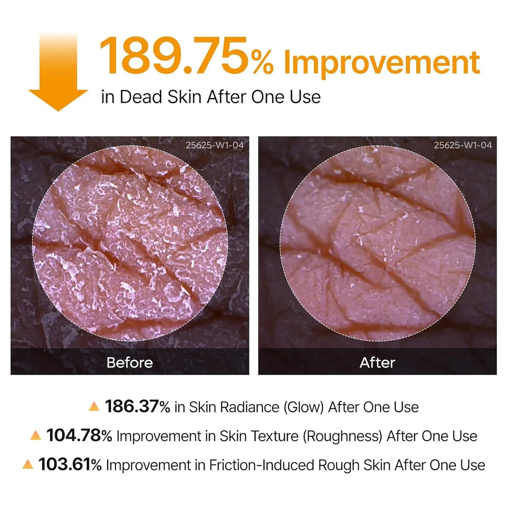 Dr.Melaxin Peel Shot Spray before and after — EmartGCC Kuwait