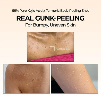 بخاخ دكتور ميلاكسين بيل شوت المقشر بحمض الكوجيك والكركم