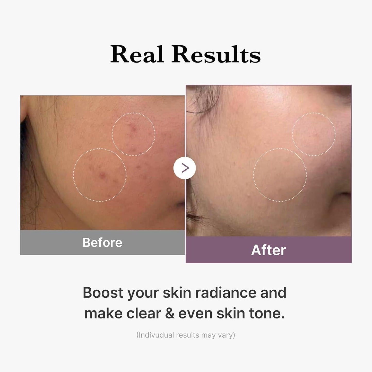 ⁠Medicube - AGE-R Glutathione Glow Toner [140ml]