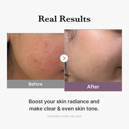 ⁠Medicube - AGE-R Glutathione Glow Toner [140ml]