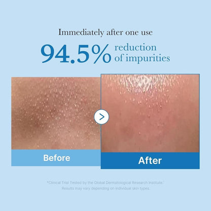 Medicube - Zero Pore Blackhead Deep Cleansing Oil [205ml]