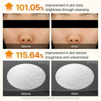 Dr.Melaxin - Peel Shot Exfoliating Kojic Acid Turmeric Serum [80ml]