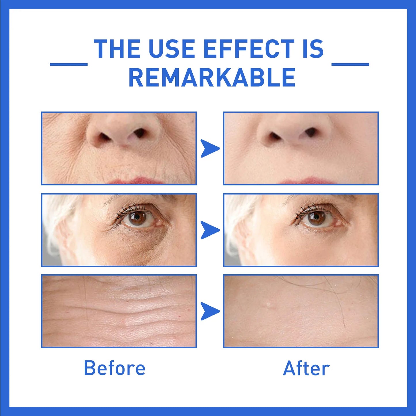 Anti-Aging BOTOX Serum