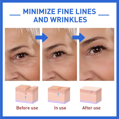 Anti-Aging BOTOX Serum