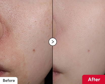 سيروم إيكوالبيري ديب سيرا فيتامين لتفتيح البشرة - 30 مل