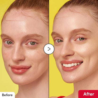 سيروم إيكوالبيري ديب سيرا فيتامين لتفتيح البشرة - 30 مل