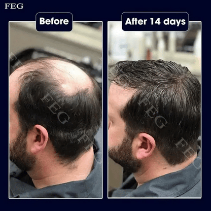 FEG Plus Serum