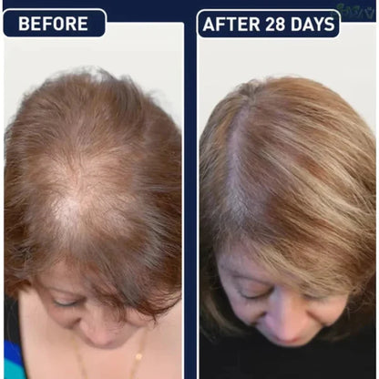 FEG Plus Serum