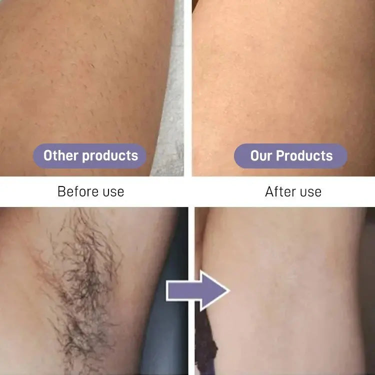Mini Laser Hair Removal Device