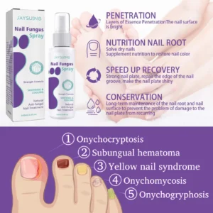 👟✨ Nail Fungus Spray – Step Confidently with Healthy, Strong Nails! ✨👟
